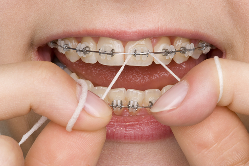 What are white spots on teeth and what can you do about them