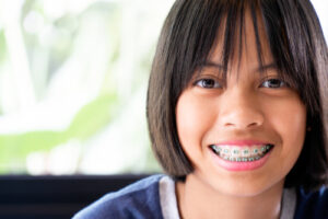 orthodontic extrusion soleil orthodontics woodinville