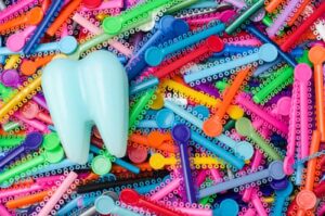 pride braces and rubber bands soleil orthodontics woodinville wa